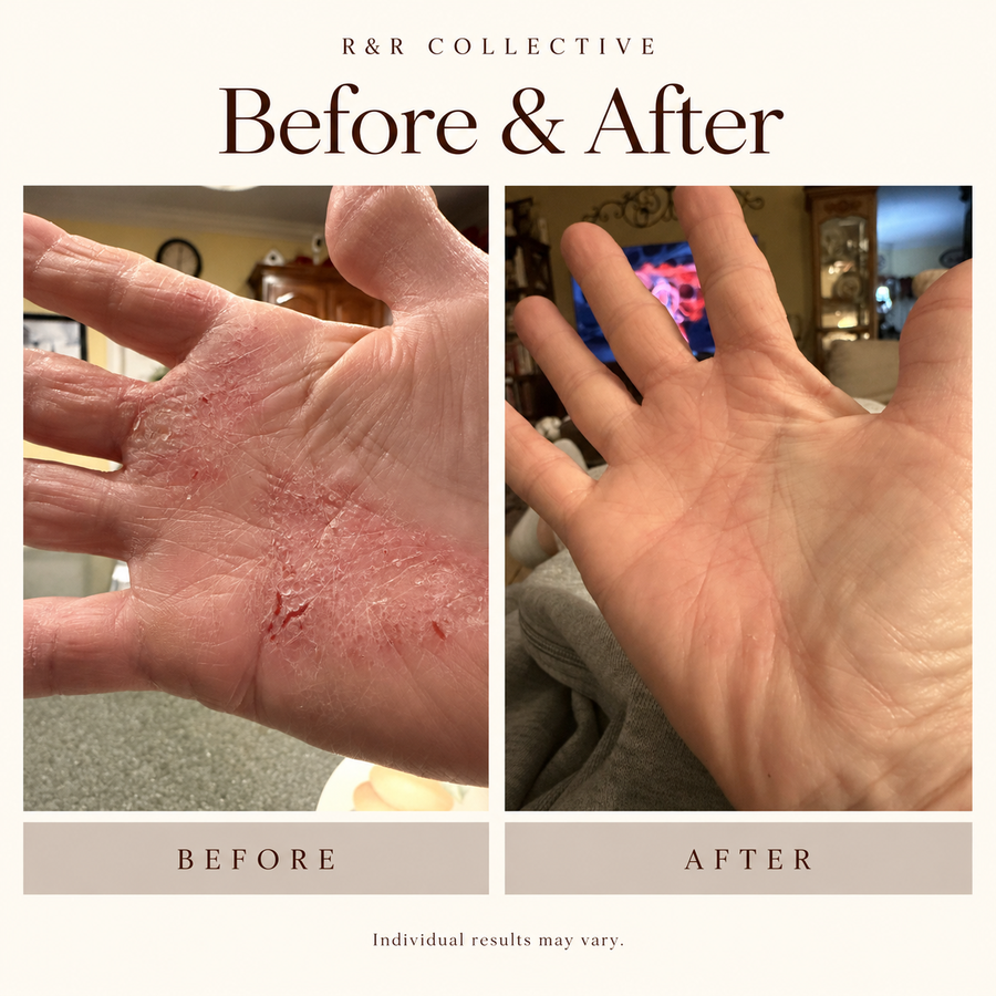 Customer before and after photo of rough, dry hands