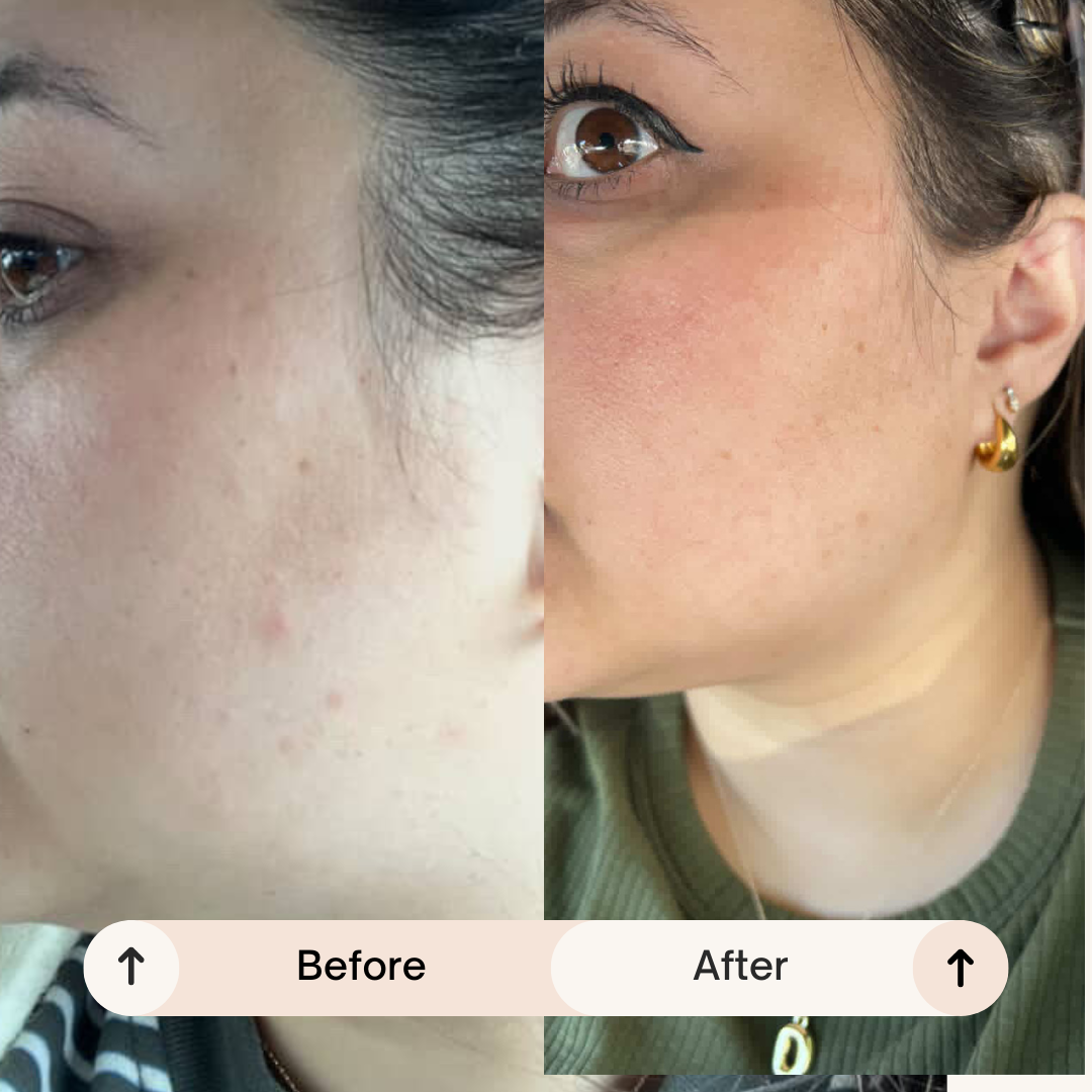 Real Stories from Our Customers: How R&R Collective Transformed Their Skin