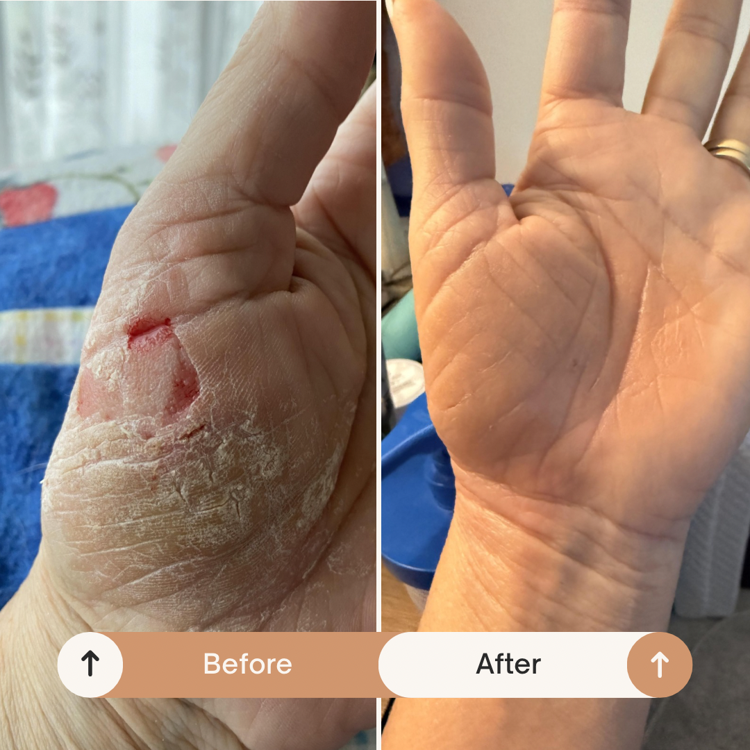 Frankincense Face Tallow Balm