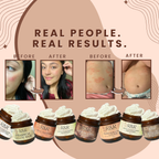 Ultimate Skincare Bundle
