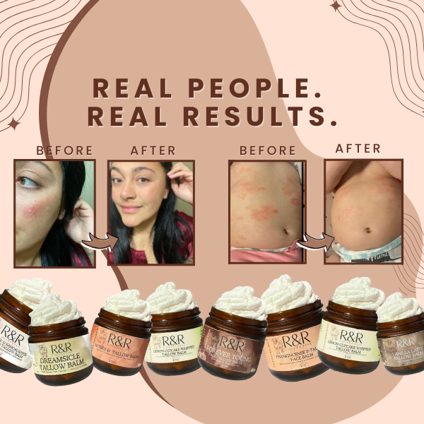 Dry Skin Bundle