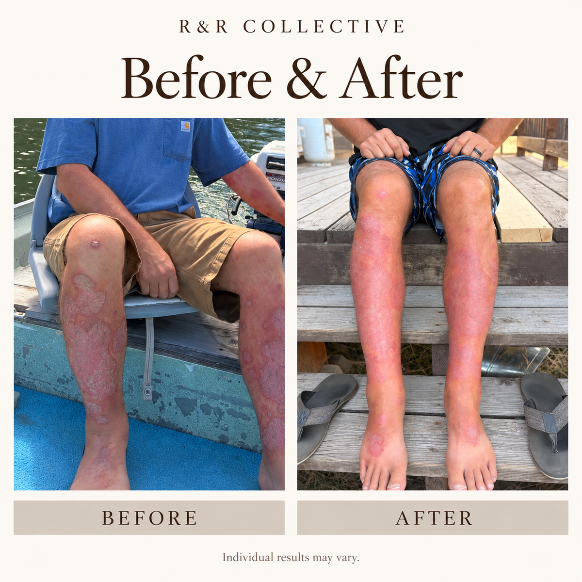 The Body Repair Ritual | Dry + Eczema-Prone Skin