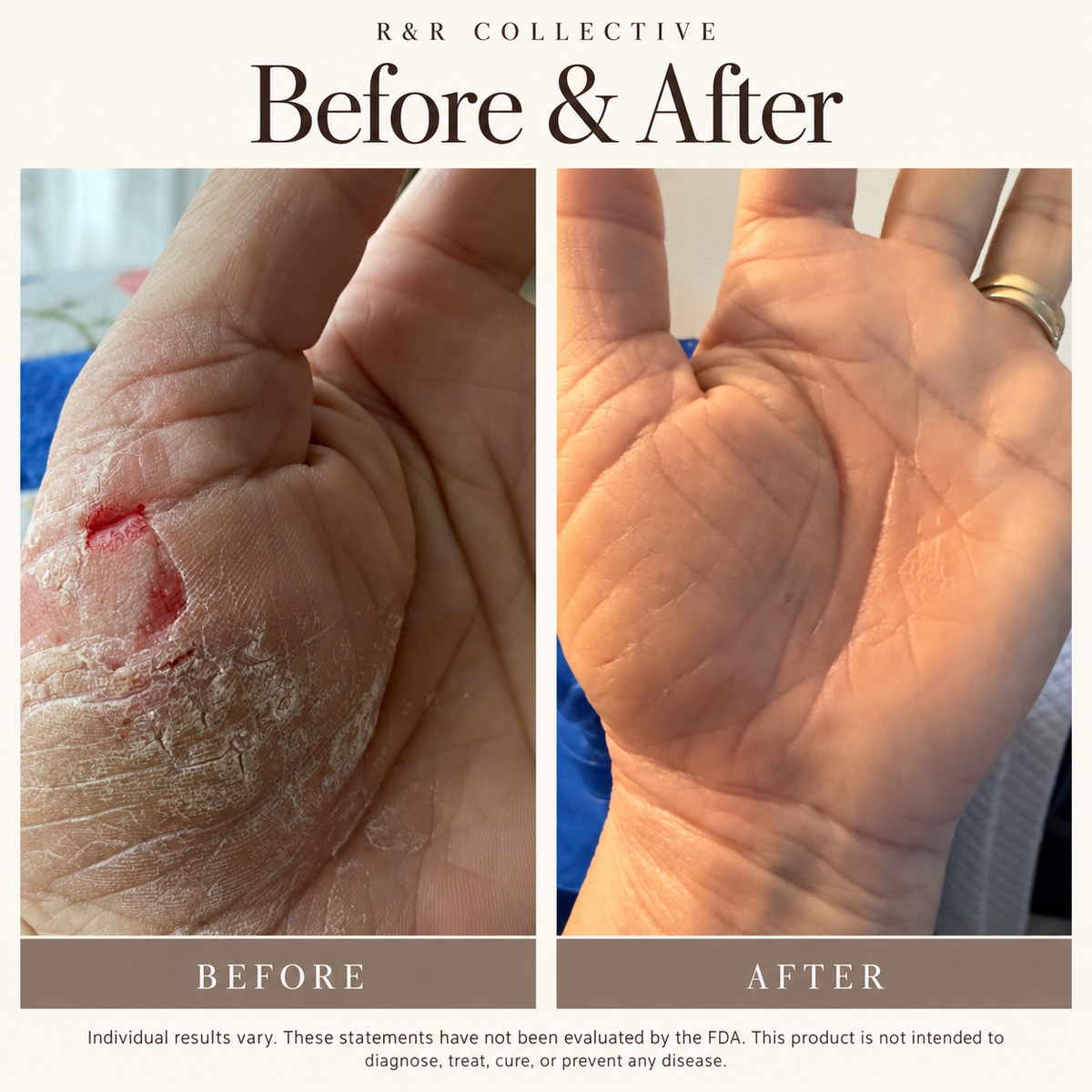 The Body Repair Ritual | Dry + Eczema-Prone Skin